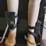 Plantar pressure insole